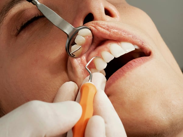 Dentist doing dental procedure